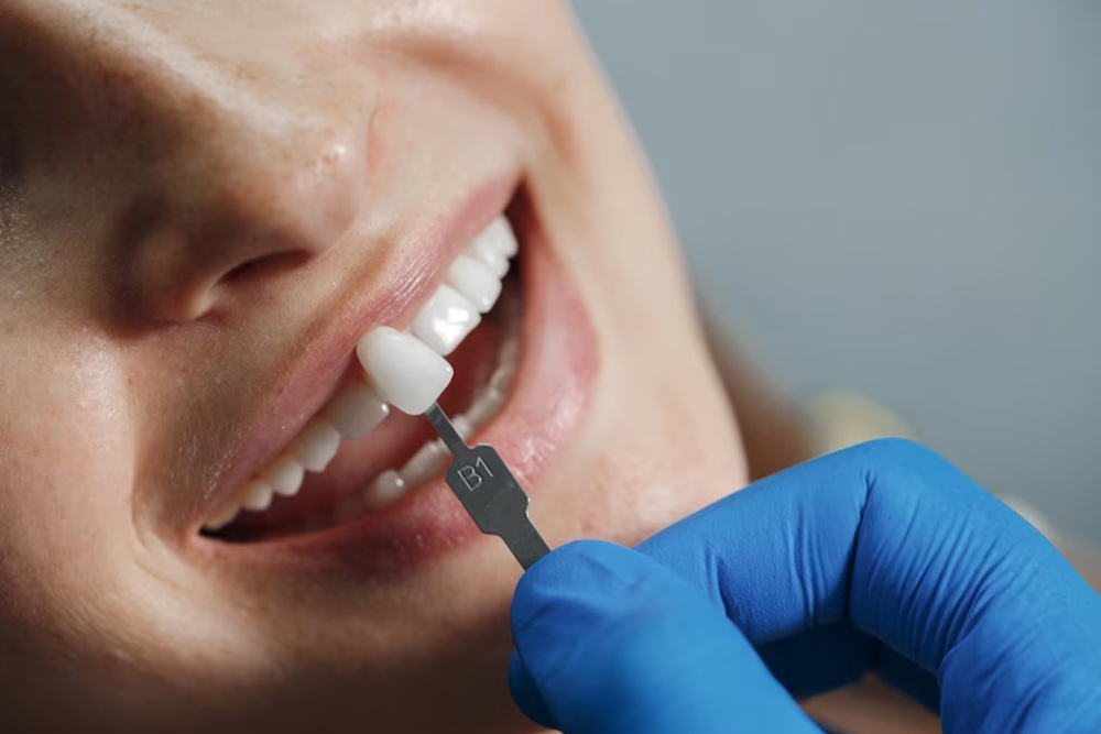 Implantología Tu Consulta Dental