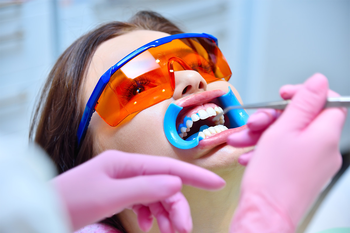 Blanqueamiento dental en clínica, nuestro producto estrella